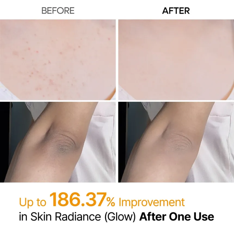Dr. Melaxin – Body Peeling Spray | Smoother Skin