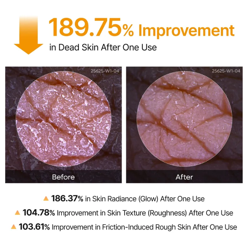 Dr. Melaxin – Body Peeling Spray | Smoother Skin