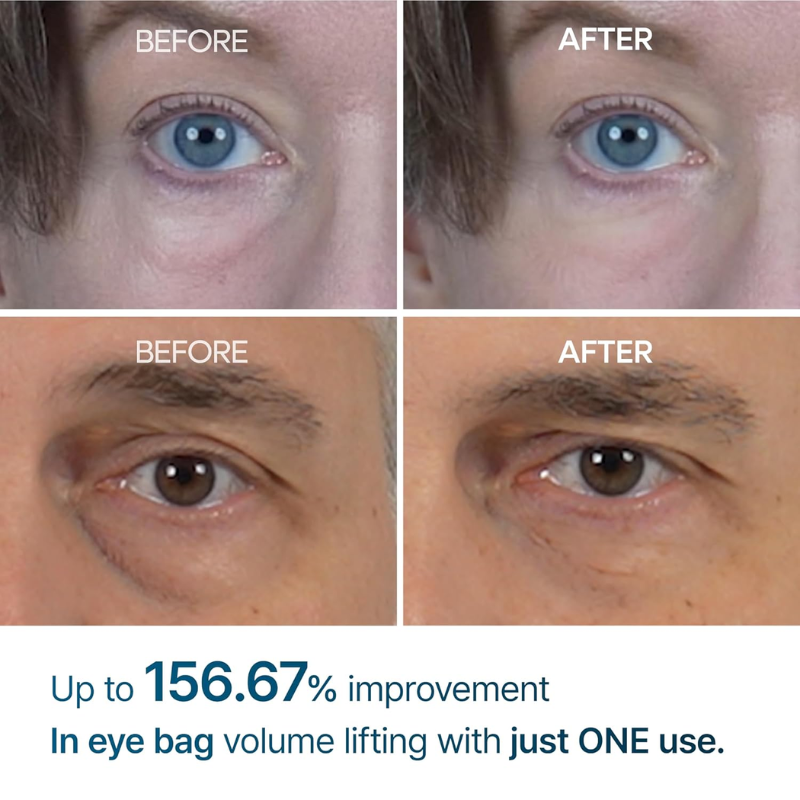 Dr. Melaxin – Eye Lift Cream | Puffiness Reduction
