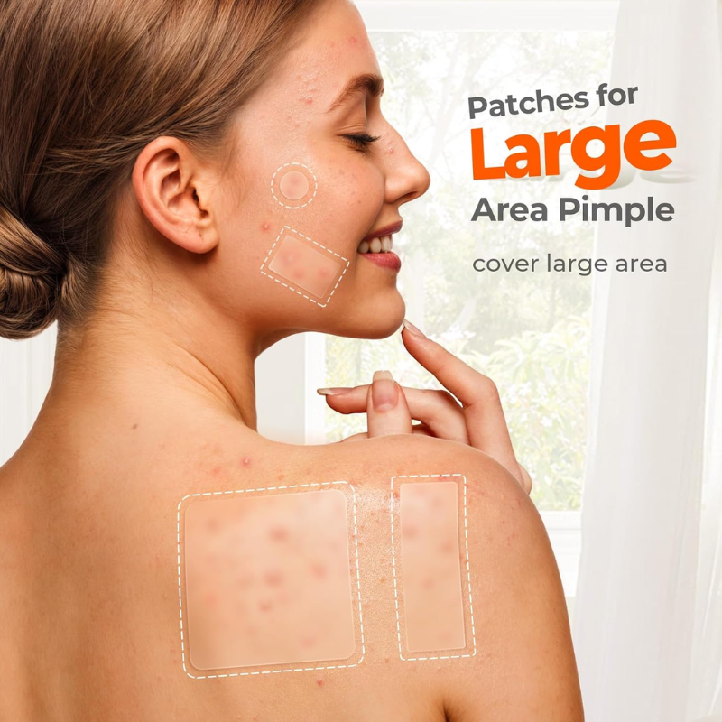 Maravelle – Acne Patch Variety Pack | Blemish Protection.