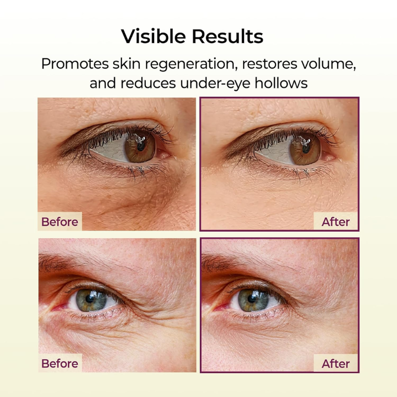 Dr. Melaxin – Volume Lift Balm | Firmness & Elasticity