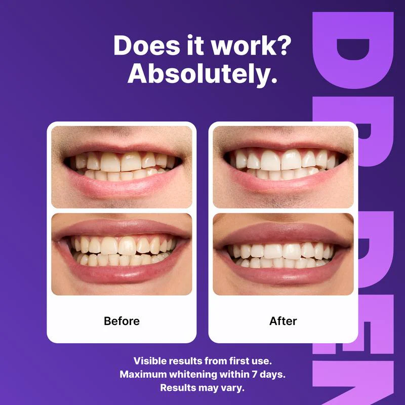Purple Whitening Strips | Enamel-Safe & Non Sensitive - Peroxide-Free