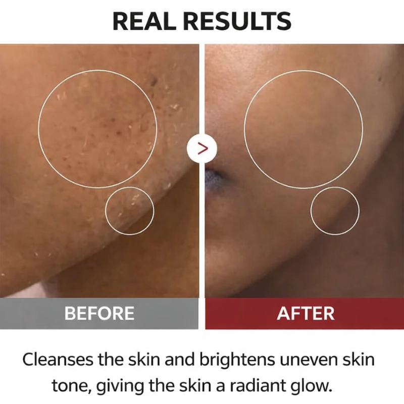 Dr. Melaxin – Rice Peel Shot Duo | Glow & Texture